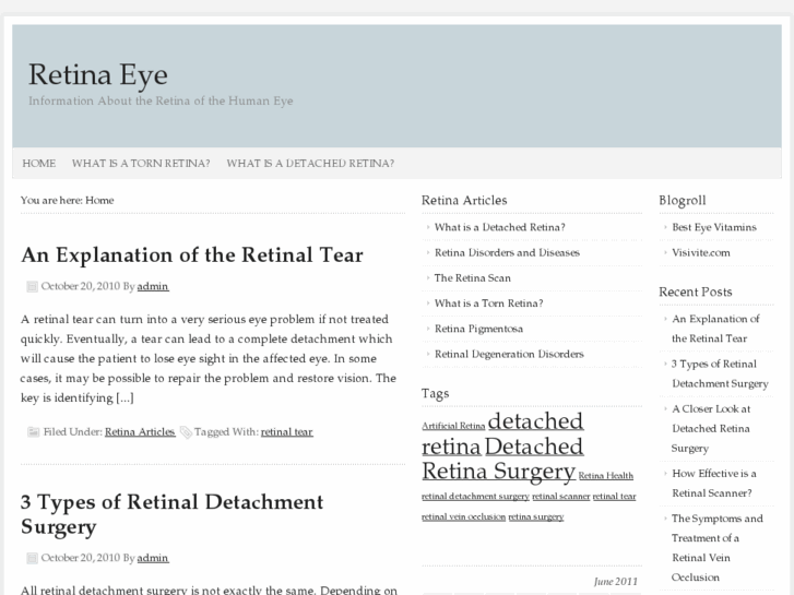 www.retinaeye.net