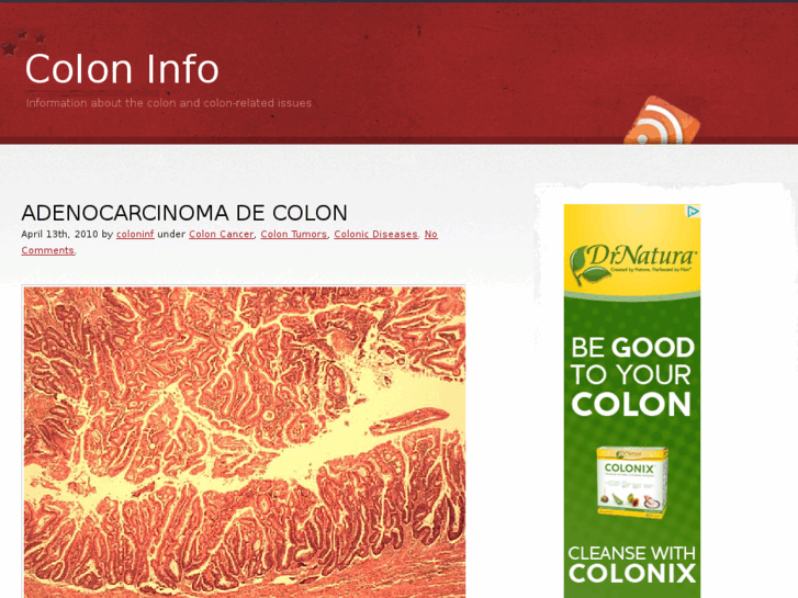 www.colon-info.com