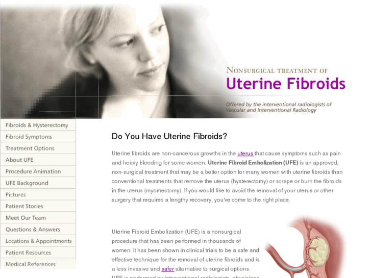 www.doctorfibroid.com