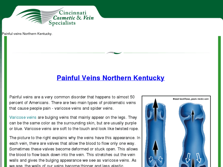 www.painfulveinsnorthernkentucky.com