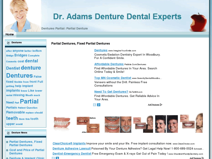 www.denturespartial.com