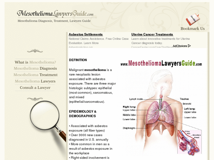 www.mesotheliomalawyersguide.com