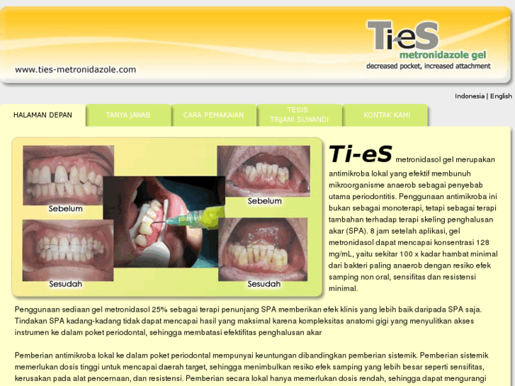 www.ties-metronidazole.com