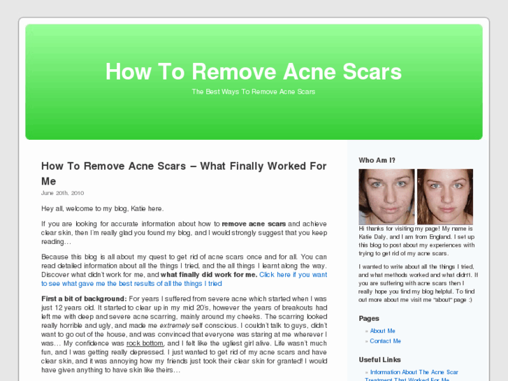 www.removeacnescarsblog.com