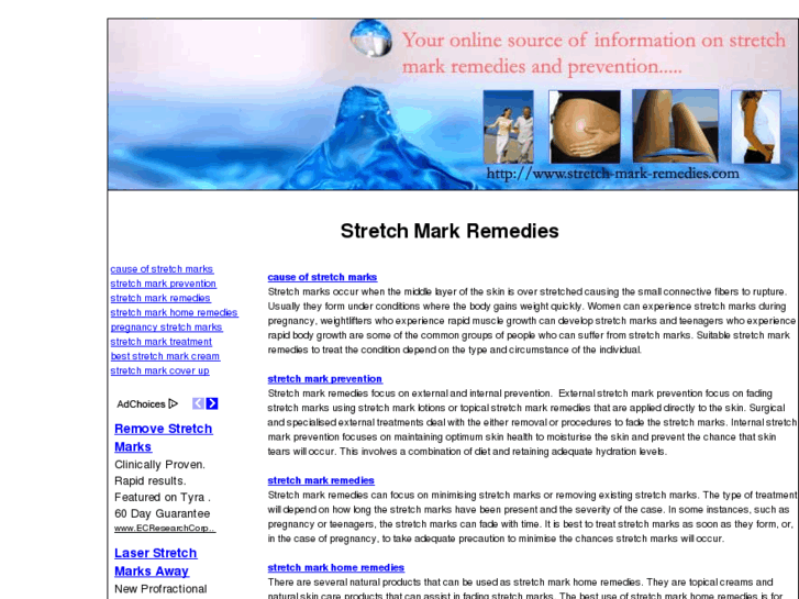 www.stretch-mark-remedies.com