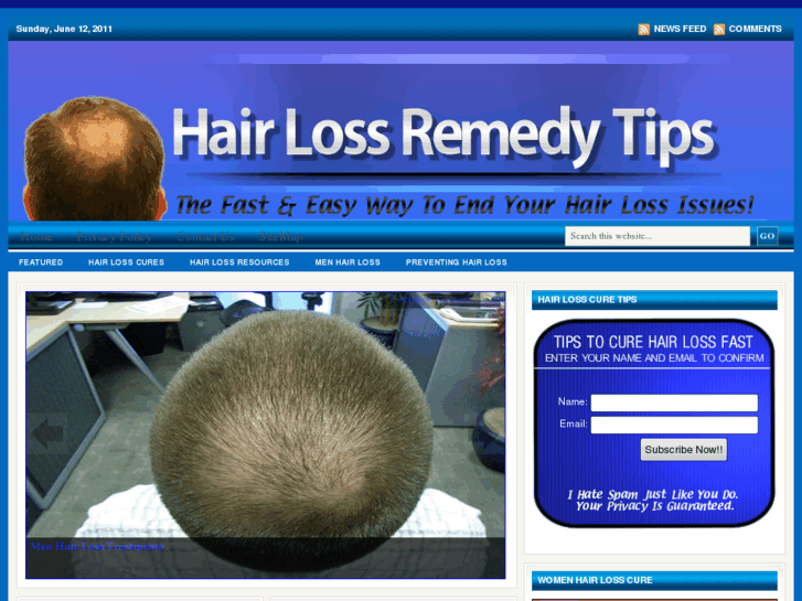 www.hairlossremedytips.com