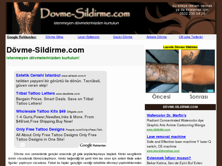 www.dovme-sildirme.com