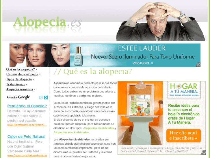 www.alopecia.es