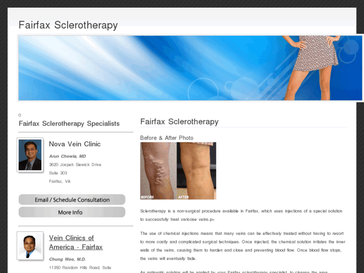 www.fairfaxsclerotherapy.com