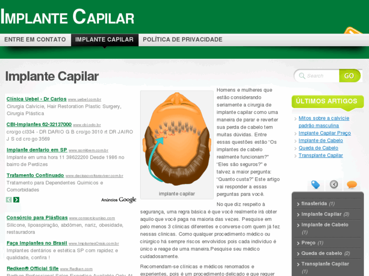 www.implantecapilar.org