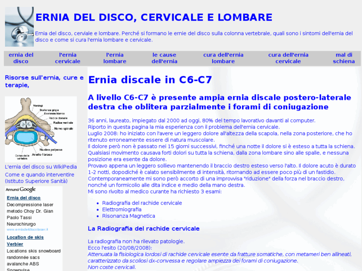 www.erniacervicalelombare.it