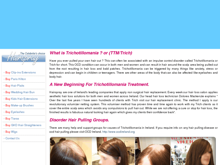 www.trichotillomania.ie