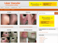 laservascular.net