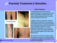 psoriasisrelieftoday.com