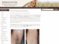 bestofphiladelphialaserhairremoval.com