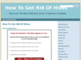 how-to-get-rid-of-hives.com