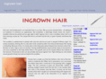 ingrown-hair.org