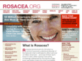 rosacea.org