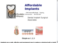 affordable-implants.net