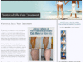 vestaviahillsveintreatment.com