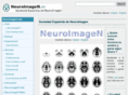 neuroimagen.es