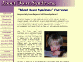 about-down-syndrome.com