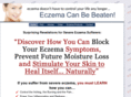 eczema-beaten.com