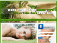 acneproneskincaretips.com