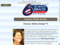 foreverwhitesmiles.com