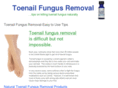 toenailfungusremoval.com