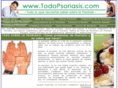 todopsoriasis.com