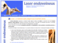 laser-endo-veineux.com