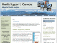 uveitis.ca