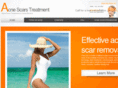 acnescars-santamonica.com
