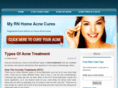 my-rn-homeacnecures.com