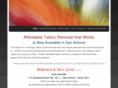 satattooremoval.com