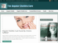 angular-cheilitis-cure.com