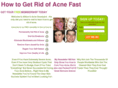 acnegraveyard.com