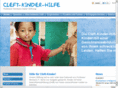 deutsche-cleft-kinder-hilfe.org
