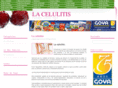 lacelulitis.net