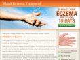handeczematreatment.com