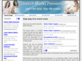 stretch-marks-prevention.com