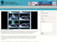 lasiksurgerytucson.com