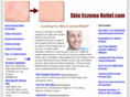 skineczemarelief.com