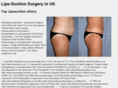 liposuctionuk.org.uk
