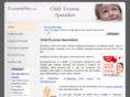 eczemasite.com