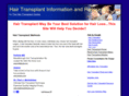 hair-transplant.com