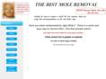 best-mole-removal.com