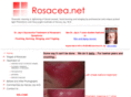 rosacea.net