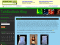 talkscoliosis.com